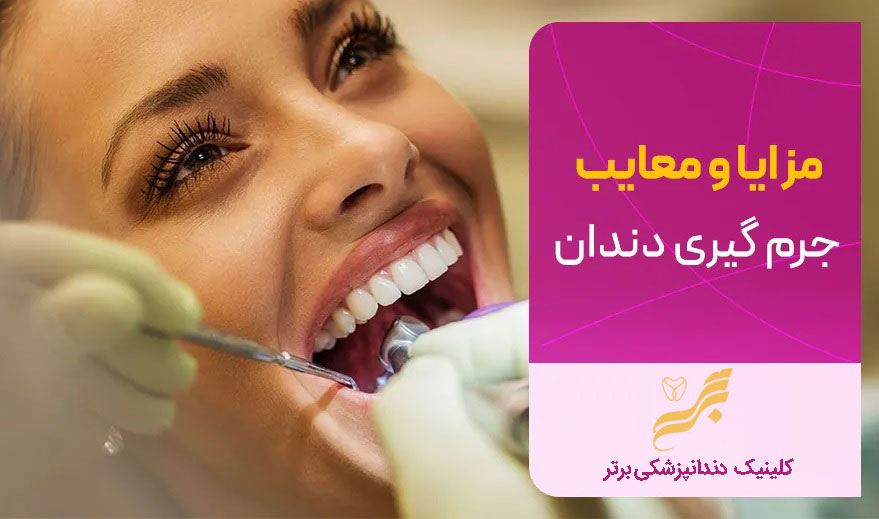 مزایا و معایب جرمگیری